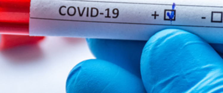 Speciale Covid-19<BR><BR>